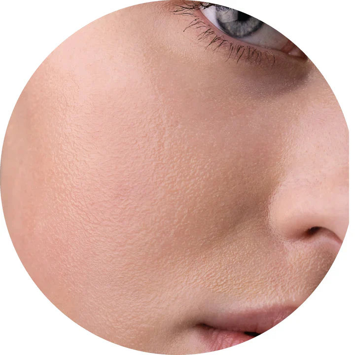 Dry Skin