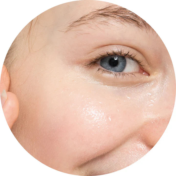 Oily Skin