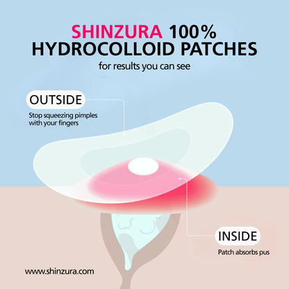 Shinzura Hydrocolloid Acne Patches with Salicylic Acid – 72 Dots