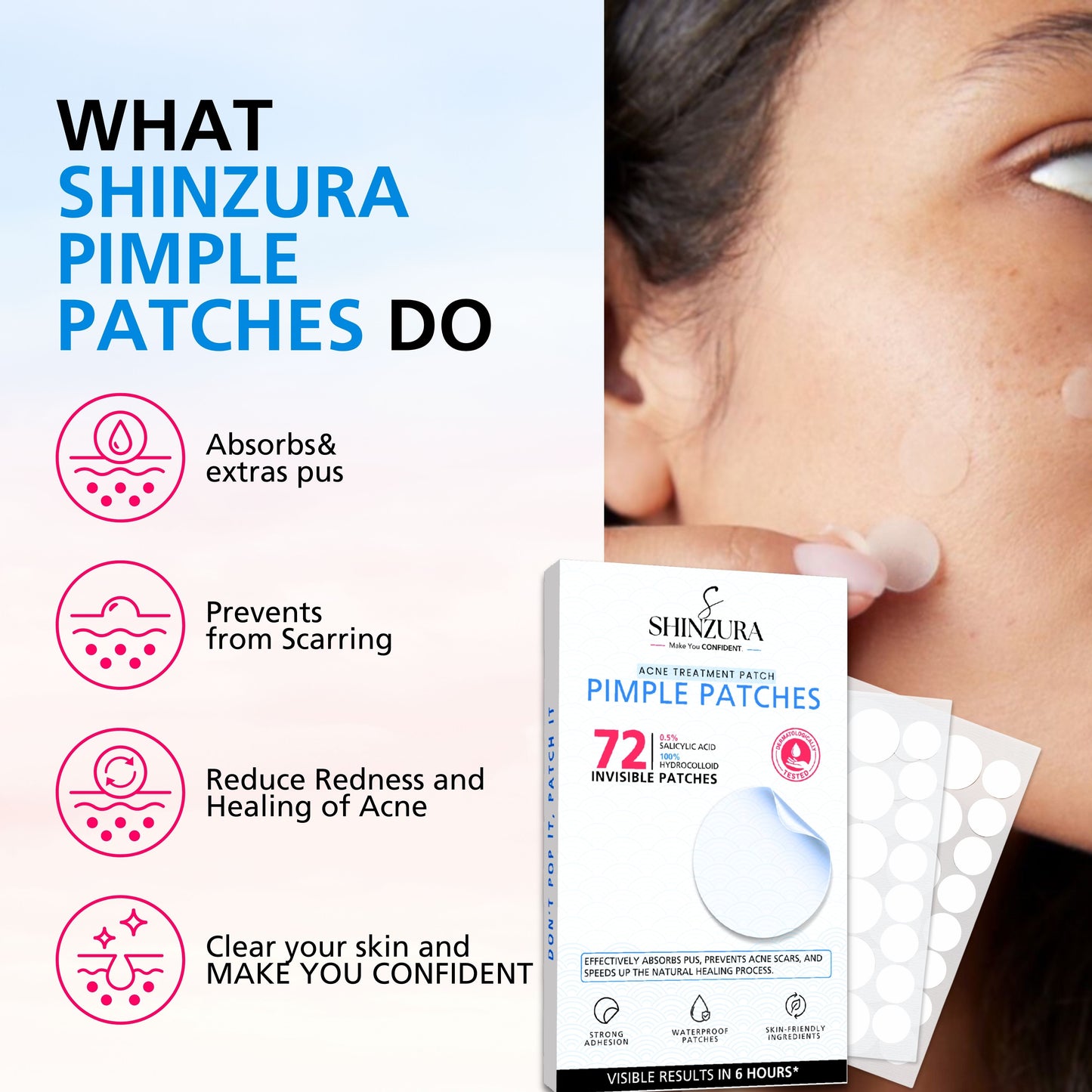 Shinzura Hydrocolloid Acne Patches with Salicylic Acid – 72 Dots