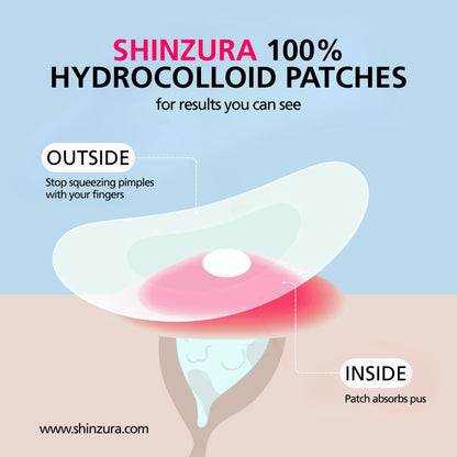 Acne Pimple Patches 36 dots - pack of 3