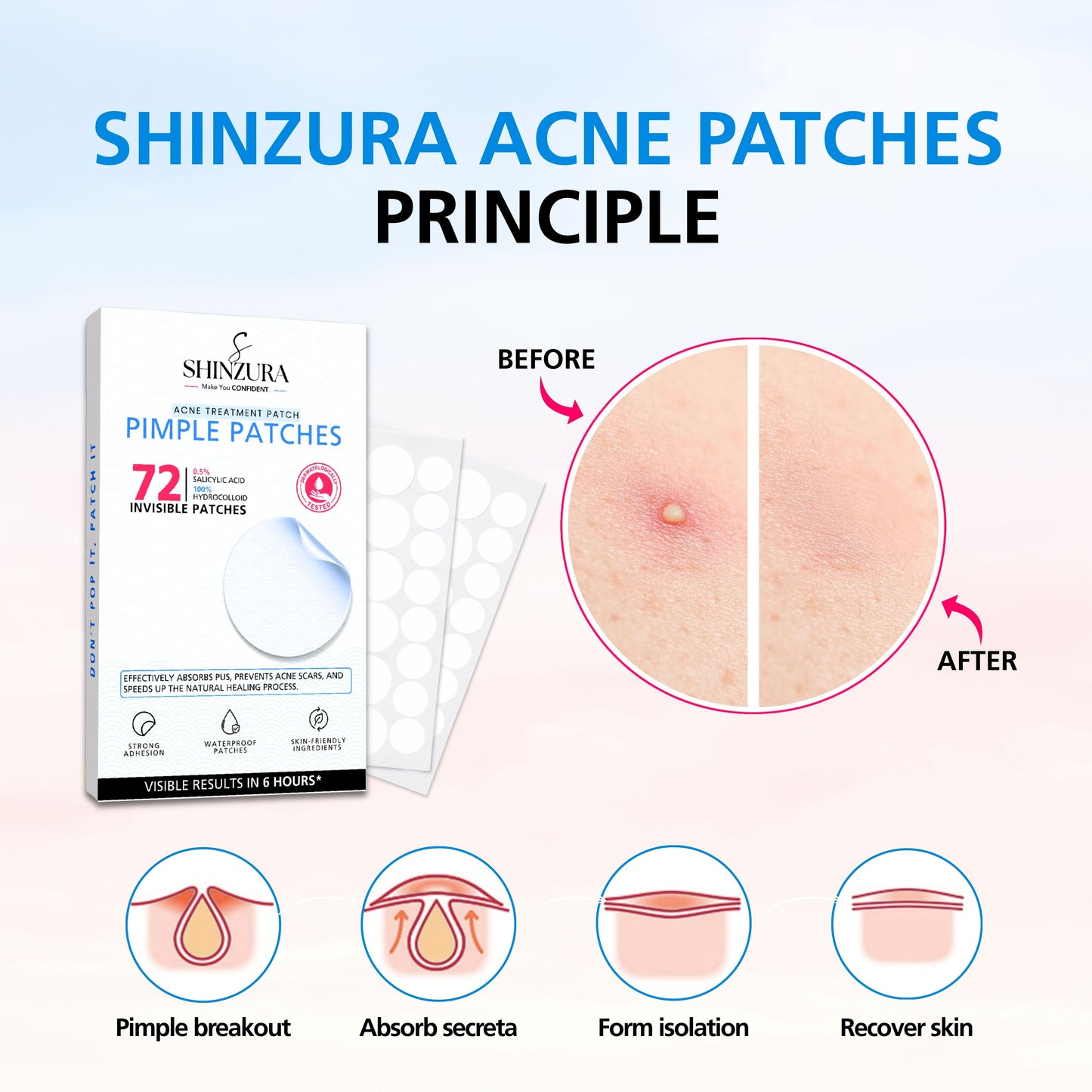 Shinzura Hydrocolloid Acne Patches with Salicylic Acid – 72 Dots