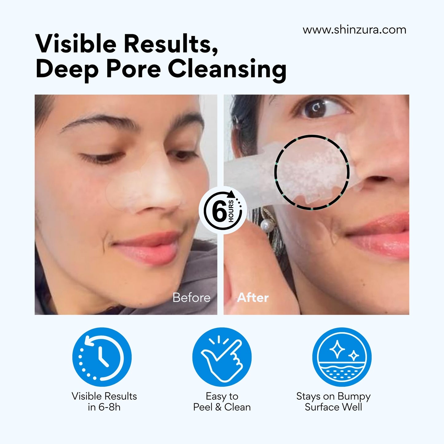 Shinzura Hydrocolloid Nose Pore Patches for Blackheads & Oil Control - pack of 30 srtrips ( 10 box x 3 strips ) for Retail shops