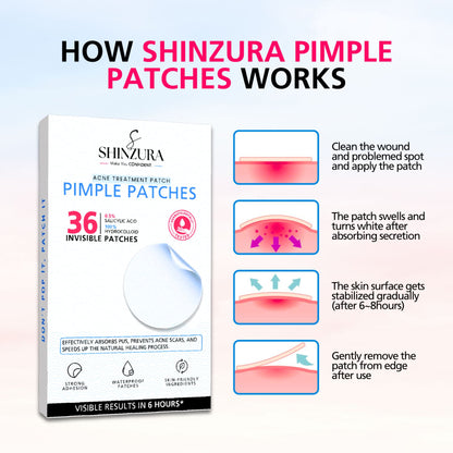 Acne Pimple Patches 36 dots - pack of 3